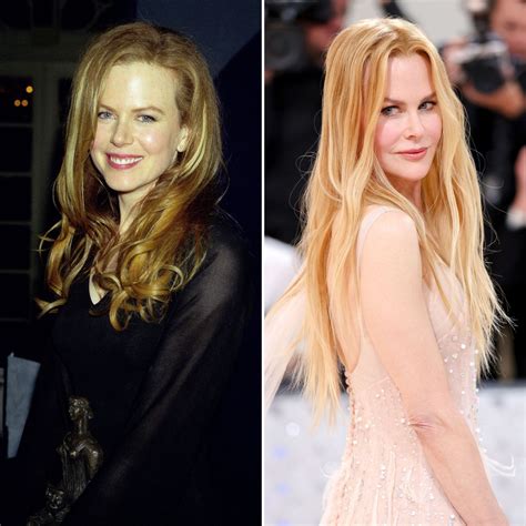 The Untold Story: Unmasking Nicole Kidman's Plastic Surgery Journey Image 15