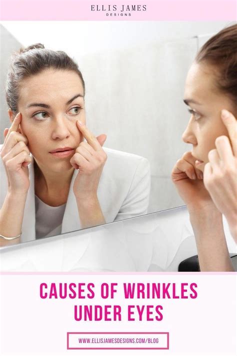 Causes of Wrinkles Under Eyes: Prevent and Treat Under Eye Wrinkles | Under eye wrinkles, Eye ...