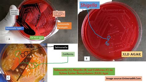 Xylose Lysine Deoxycholate XLD Agar Introduction Principle Preparati