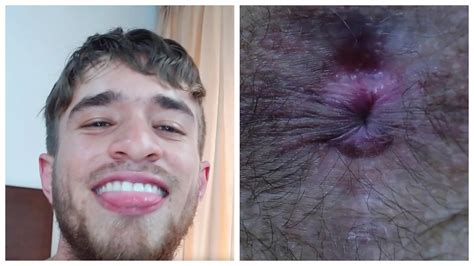 Hot Str Guy And His Close Up Musky Hole ThisVid