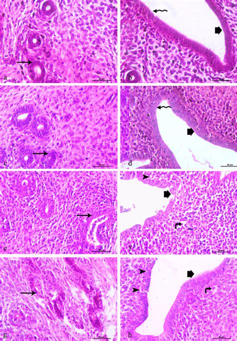 Representative photomicrographs (H/E staining) depicting uterine ...
