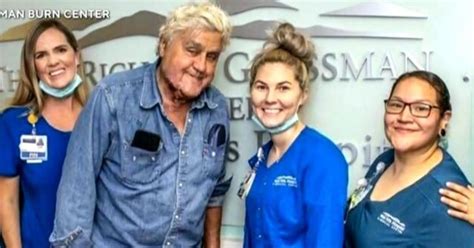 Jay Leno Makes Light Of His Recent Burn Accident Cbs Los Angeles