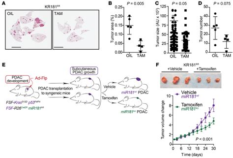 Mutant Kras Lung And Pancreatic Cancer Progression Is Dependent On