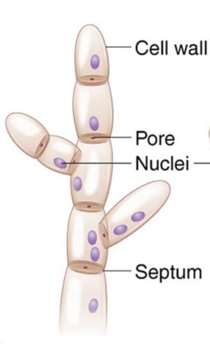 NRSG 205: Microbiology Chapter 12 Flashcards | Quizlet 