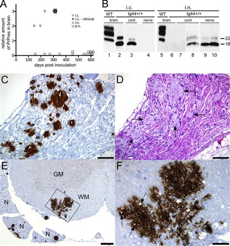 PrPres Deposition In Sciatic Nerve And CNS Following Intracerebral And