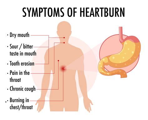 Chest Pain Heartburn Feeling at Hudson Slattery blog