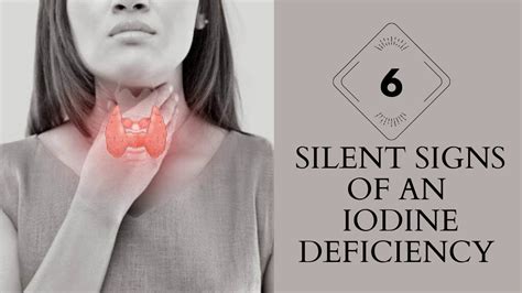 Early Signs Of Iodine Deficiency Signs And Symptoms Of Iodine