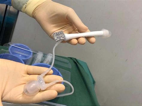 frontier  penile implants  phalloplasty   zsi  ftm