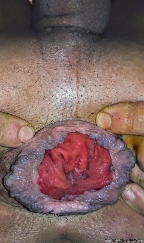 My Ass Opened Pics Xhamster
