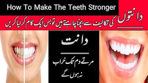 Dant K Dard Ka Fori Ilaj Dant Mein Dard Ka Rohani Ilaj Teeth Pain