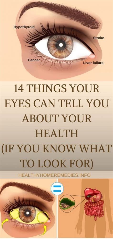 14 Things Your Eyes Can Tell You About Your Health If You Know What Look For Healthy Home