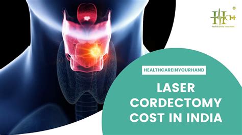 laser cordectomy cost  india hch healthcare   hand