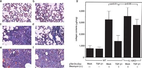 Amelioration Of Bleomycin Induced Lung Fibrosis By Intranasal