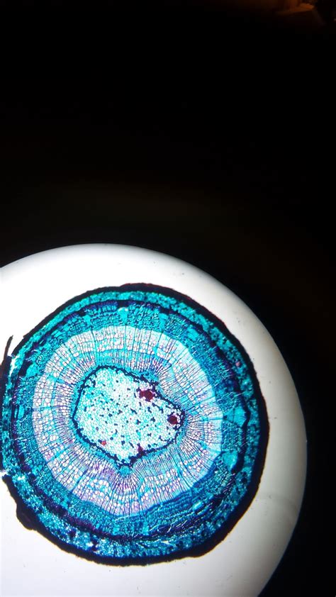 elodea stem cell   microscope smithsonian photo