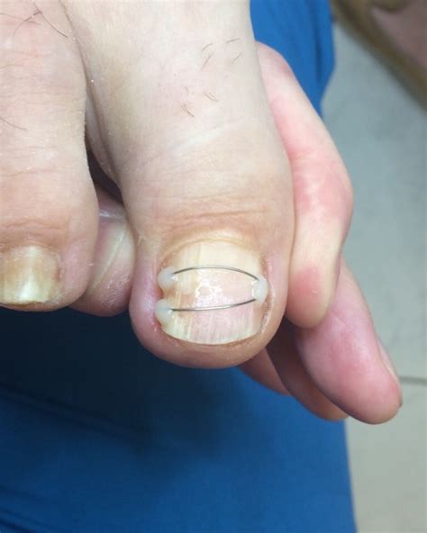 Титановая нить - Мастерская красоты "Сатори"