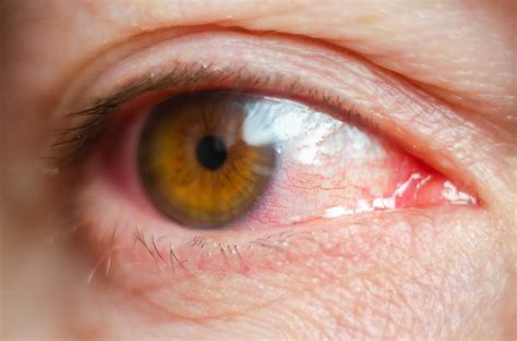 Eye & Gynecology Hospital in Lucknow | Eye & Gynecology Specialist in