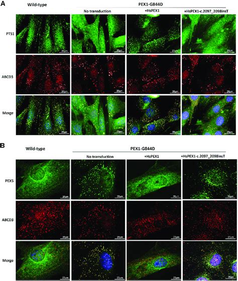 hspex recovers peroxisome import  pex localization  murine