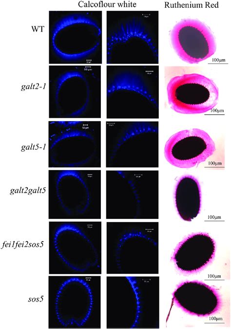 Staining Of Seed Coat Mucilage For Cellulose And Pectin In Wild Type