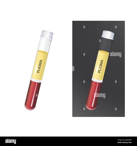 Platelet Rich Plasma PRP In Glass Collection Tube For Plasma Therapy