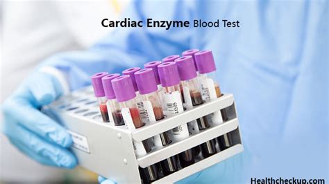 Cardiac Enzymes Blood Test | ubicaciondepersonas.cdmx.gob.mx