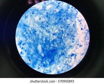 Sputum Afb Stain Afb Positive Stock Photo 570905893 | Shutterstock