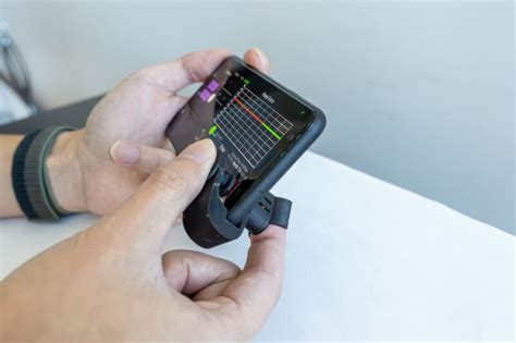 Ultra Low Cost Smartphone Attachment Measures Blood Pressure At Home