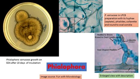 Fungi General Characteristics Classification Morphology Pathogenecity