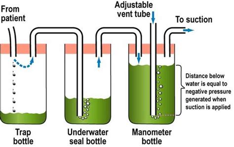 water seal drainage nurses revision