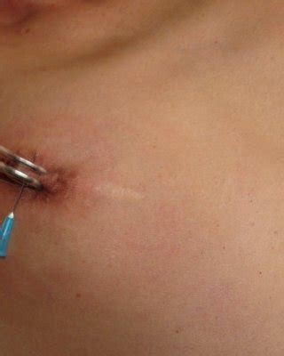 Extreme Amateur Needle Pain And Nipple Piercing Tortures Of European Painslut Pu Porn Pictures