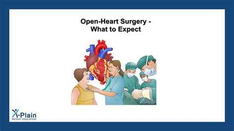 Open Heart Surgery What To Expect Youtube