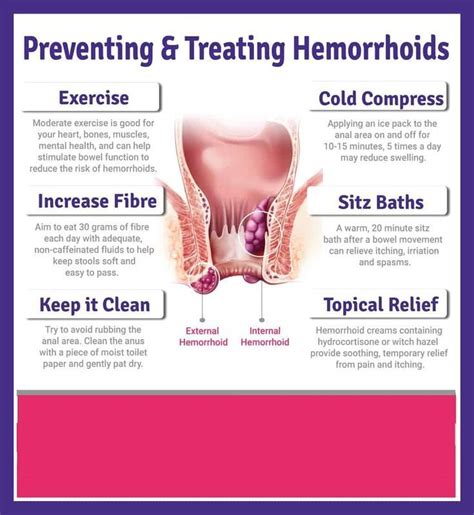 Best 13 Anal Fistula Symptoms Causes Types Complications Prevention Artofit