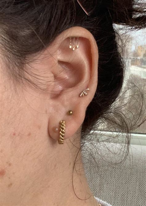 2nd Lobes Still Not Healed After 6 Months What To Do More In