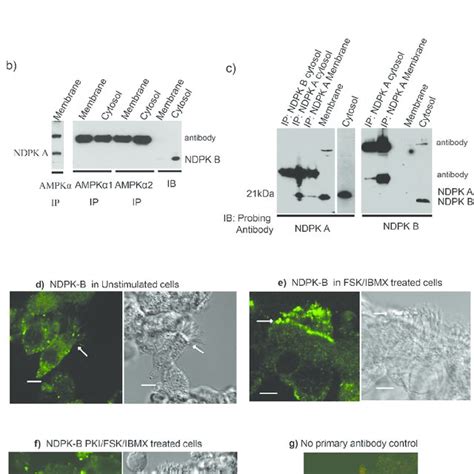 Pka Regulates Translocation Of Ndpk B In Airway Epithelial Cells A