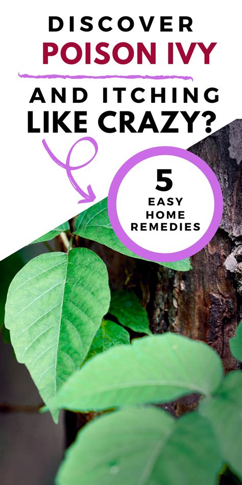 18 Home Remedies For Poison Ivy Plus The Best Remedy Ever Artofit