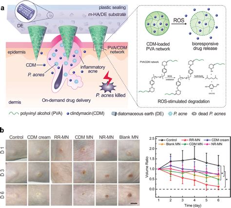 A Schematic Of The Preparation And Mechanism Of A Ros‐responsive