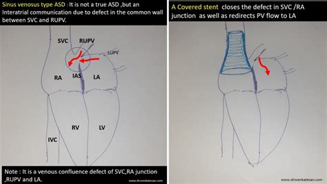 Svc Asd Drsvenkatesan Md