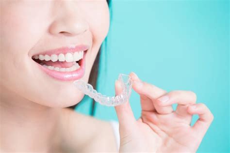 How Long Does It Take To Straighten Your Teeth With Invisalign