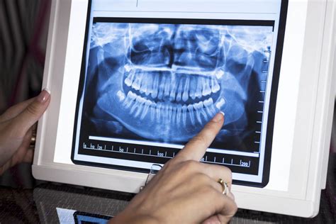 Dental X Rays Carrollton Smiles