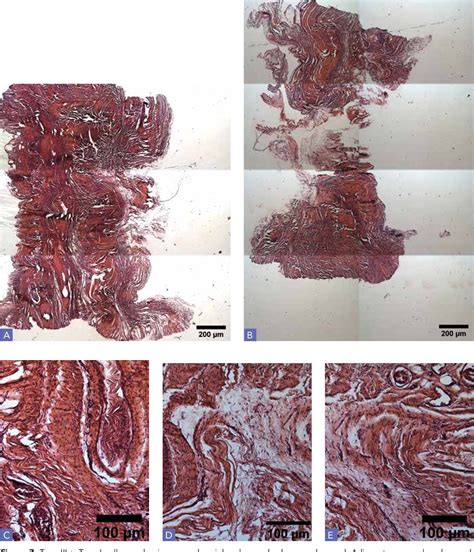 Figure From Epidermal Growth Factor Stimulates Rabbit Achilles Tendon