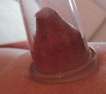 Huge Nipples Pumping And Bondage Porn Pictures XXX Photos Sex Images 3015975 PICTOA