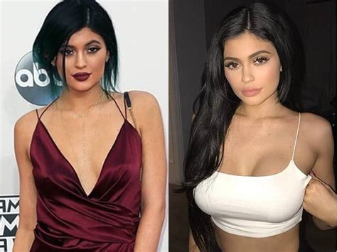 Kylie Jenner, Before and After Transformation