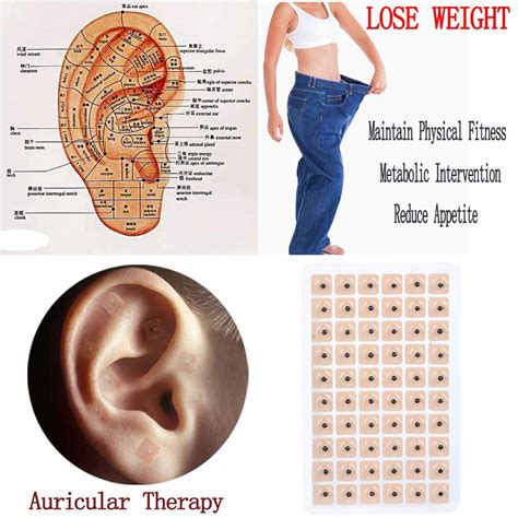 Weight Loss Printable Ear Seed Placement Chart