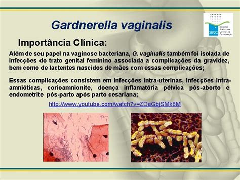 O Que É Gardnerella Vaginalis - MICROBIOLOGIA AULA 8 Listeria Bacillus Corynebacterium e Gardnerella