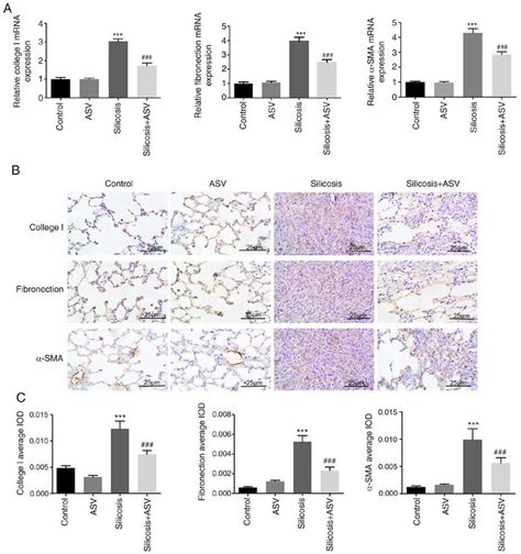 Asv Treatment Reduces The Expressions Of Collagen I Fibronectin And