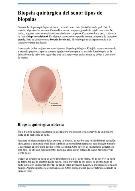 Text Biopsia quirúrgica del seno tipos de biopsia HealthClips Online