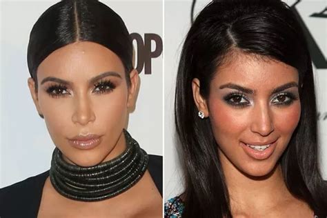 Kardashians Before And After Photos