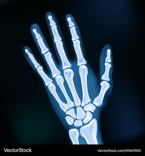 Realistic 2d X Ray Hand Dark Medical Image Vector Image