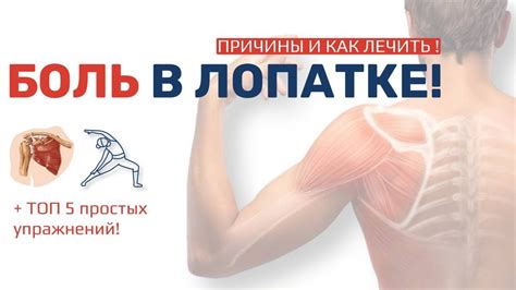 БОЛЬ В ЛОПАТКЕ? Причины и лечение! Топ 5 упражнений от специалиста по ...