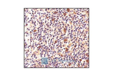 HSP70 Antibody | Cell Signaling Technology