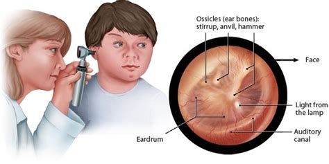 What Do Ear Examinations Involve